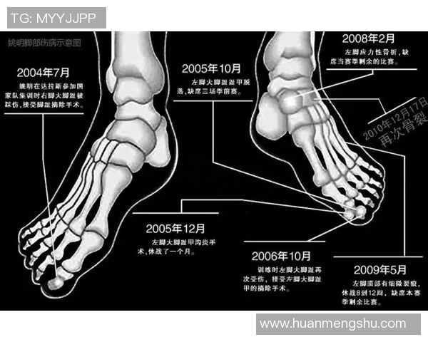 左脚应力性反应&本季还未出战！Scotto：尼昂一周后接受复查